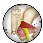 Piriformis Sciatica